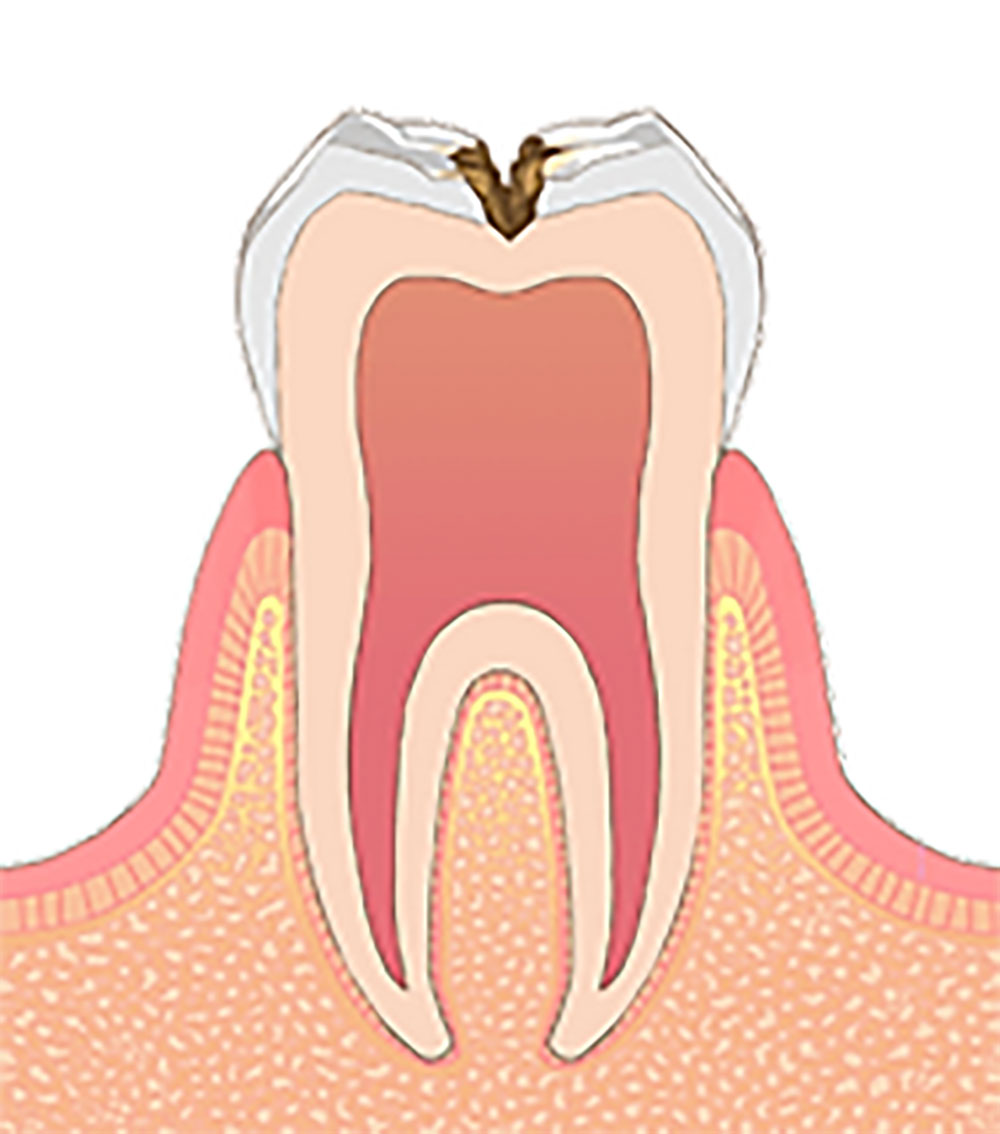 C02
